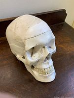 Front perspective of skull showing overall form and dentition