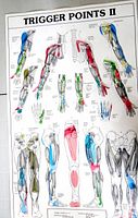 Laminated Trigger Points II anatomy poster showing limb views