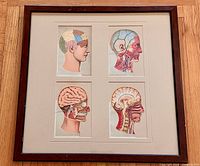 Full view of framed set showing four anatomical head plates