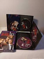 Slipcase, two open DVD cases, visible discs