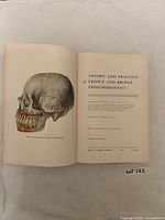 Open book showing color plate of skull and title page