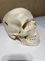 Right side view of skull showing detachable calvarium line and metal hook