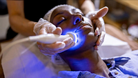 Client receiving facial laser treatment