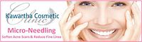 Promotional banner showing gift certificate aesthetics with smiling woman and micro-needling info