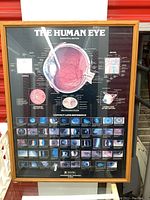 Framed medical poster showing large cross-section of human eye and contact lens reference images, minor wear on wood frame