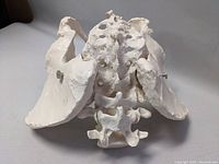 Pelvis model viewed from the back showing sacrum with openings and attached iliac bones with screws.