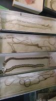 Top-down photo of gold tone necklaces and bracelets in padded boxes showing damaged pieces and various chain styles.