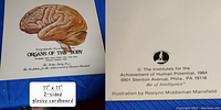 Front side of a glossy cardboard card showing detailed brain illustration and title.