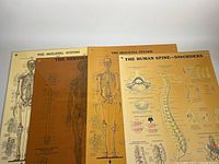 Four vintage anatomical educational wall charts showing skeletal and nervous systems, and human spine disorders.